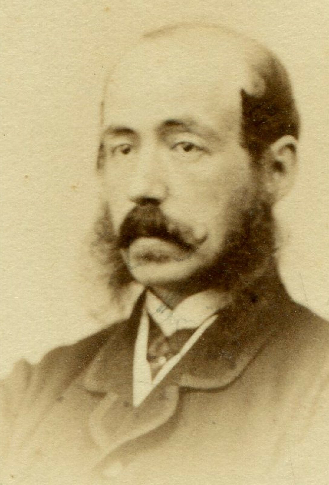 BALDING MAN W/MUTTON CHOP SIDEBURNS, MUSTACHE AND BORED EXPRESSION. CDV. ITALY.