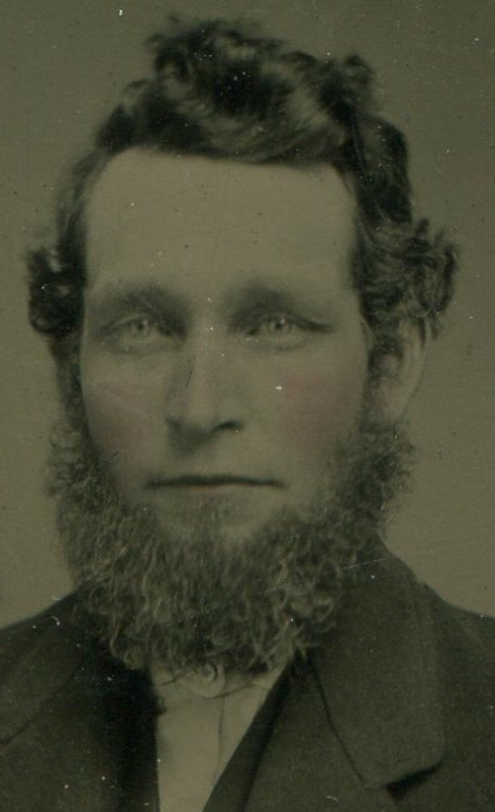 SAD EYED MAN, FUZZY BEARD. TINTED TINTYPE, PERIOD PAPER MAT. PHILADELPHIA, PA.