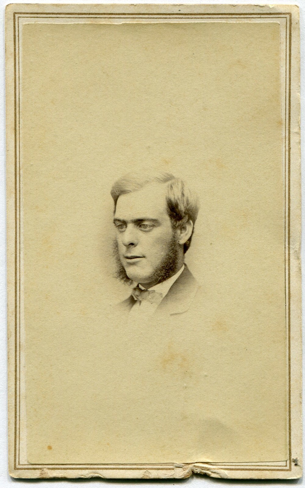 MAN WITH BIG EYES, DOWNWARD GAZE. CDV.