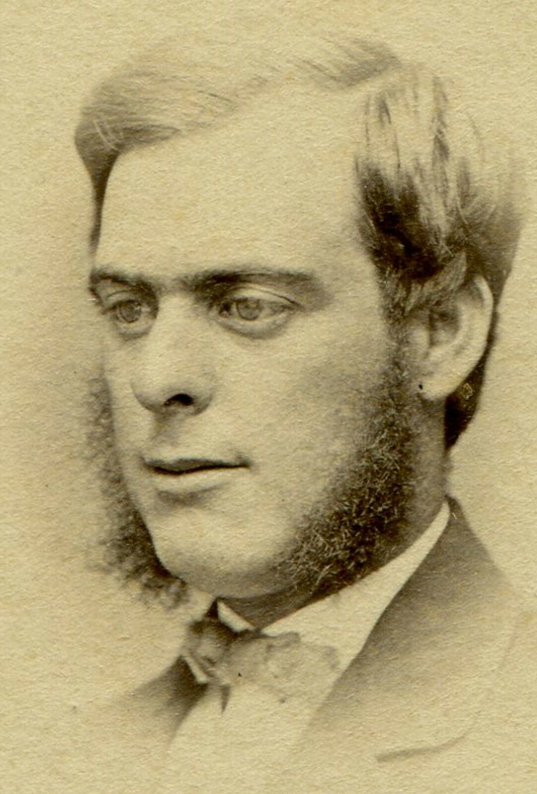 MAN WITH BIG EYES, DOWNWARD GAZE. CDV.