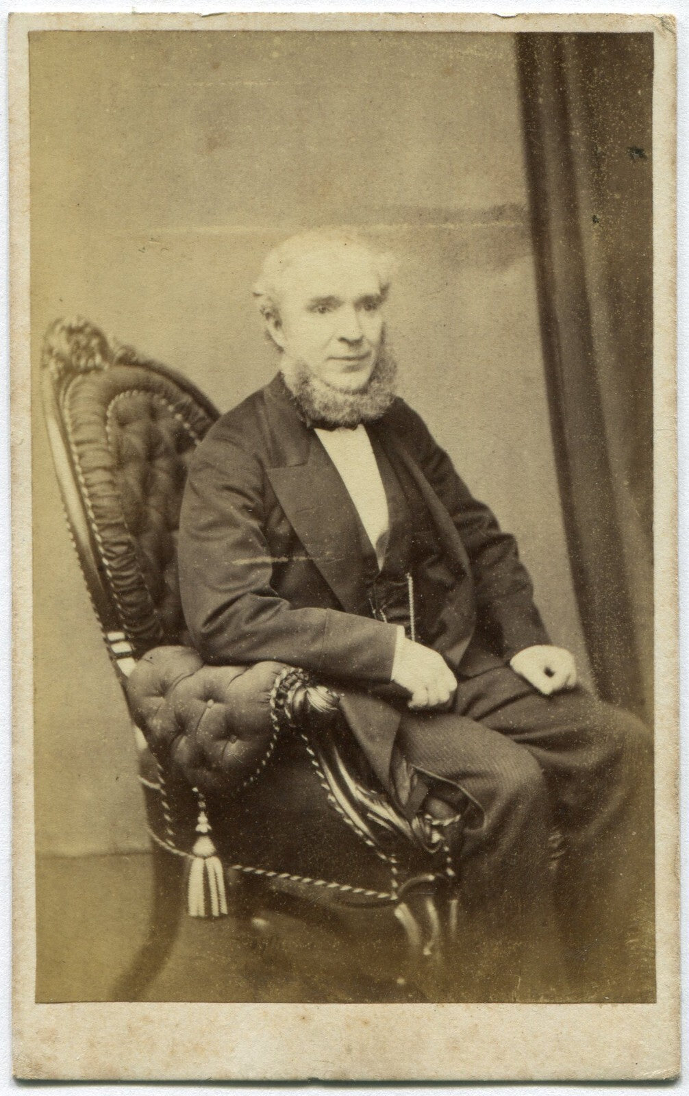 MAN WITH FUR LIKE NECK BEARD. CDV. DUBLIN, IRELAND.