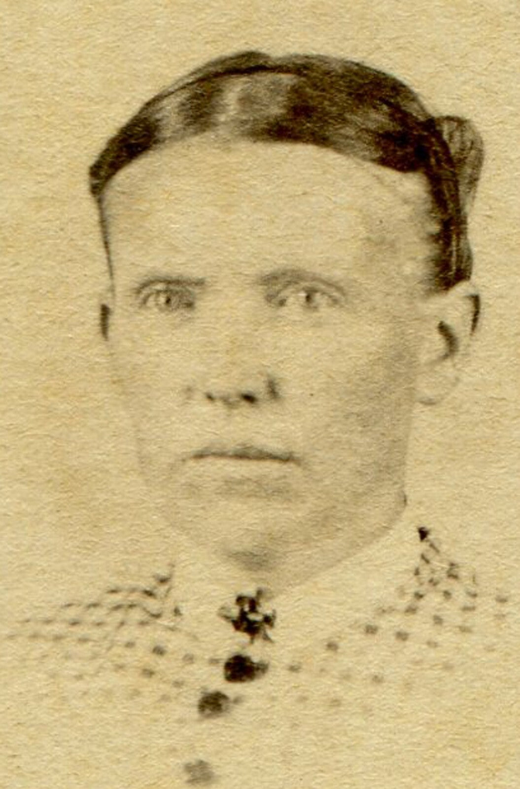 WOMAN W/ VERY UNFORTUNATE HAIRSTYLE. CDV. BLUFFTON, IND.