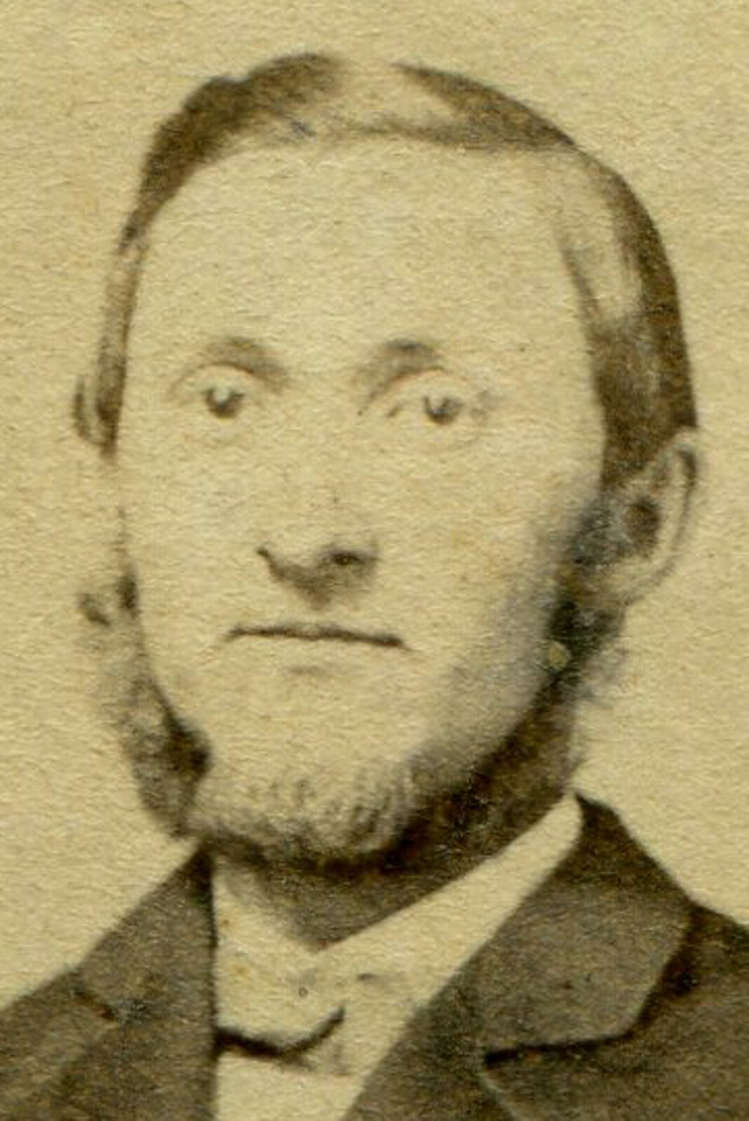 THIN LIPPED MAN W/CHIN BEARD. CDV.