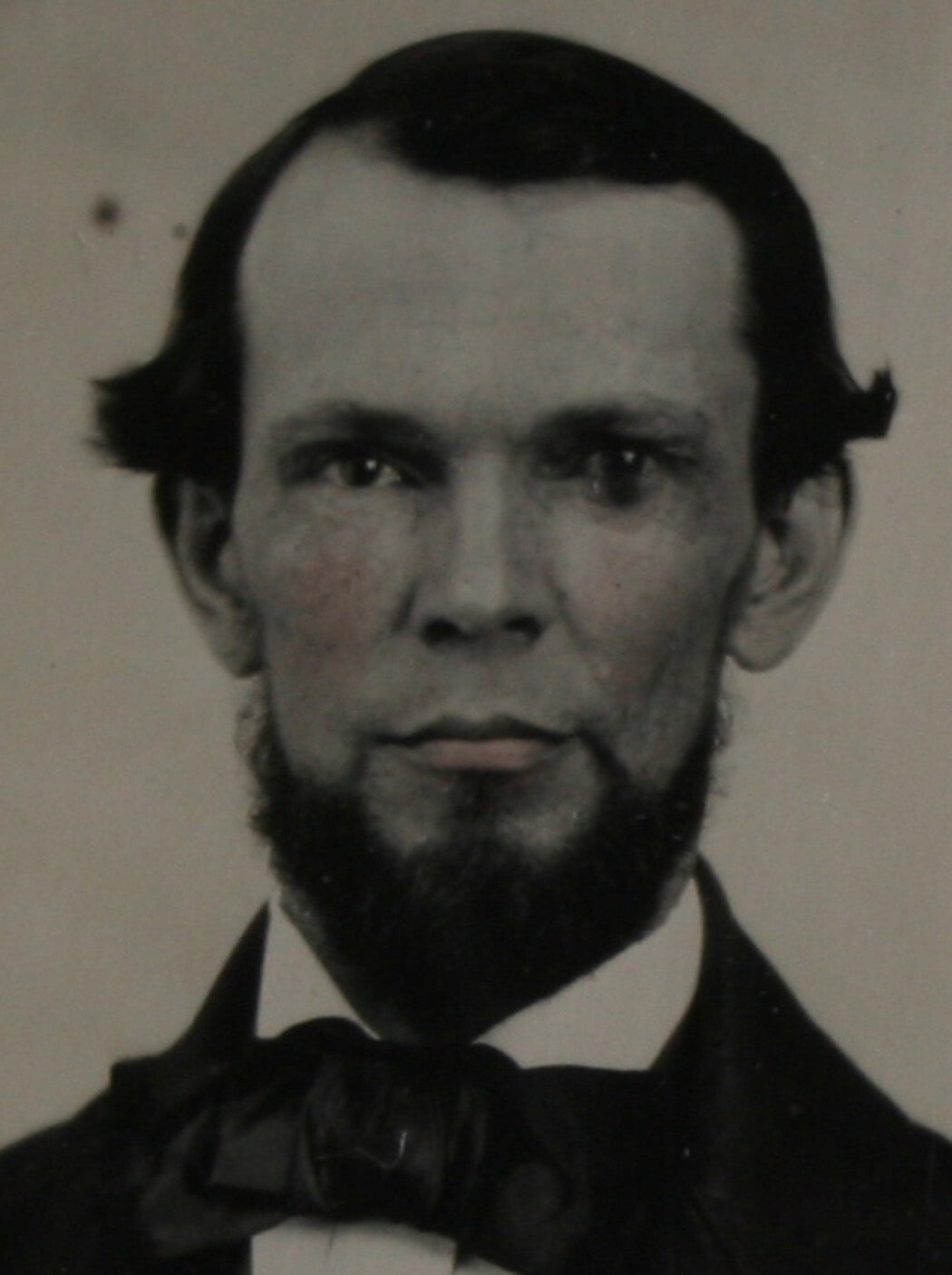 BEARDED MAN, DATED JULY 20, 1859, AMBROTYPE. TINTED, CRISP 6TH PLATE, FULL CASE