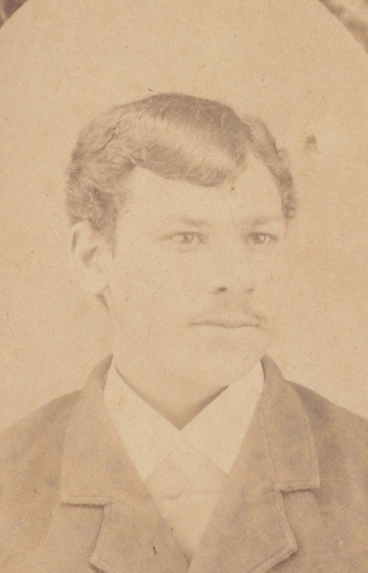 Young Man w/ Patchy Mustache and Anger in His Eyes. CDV. Pennsylvania.