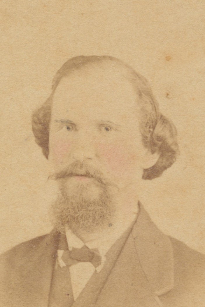 Man w/ Scraggly Hair, Beard in Three Piece Suit. Hand Tinted CDV. Petersburg, VA