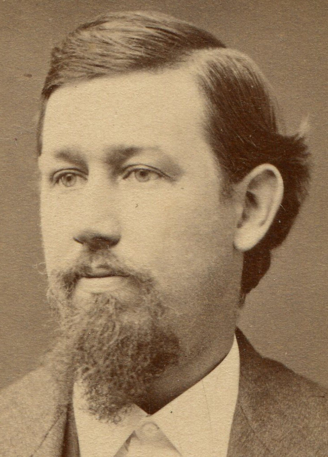 MAN WITH BEARD AND HAIR FLIP BEHIND EAR. CDV. ADAMS, MASS.