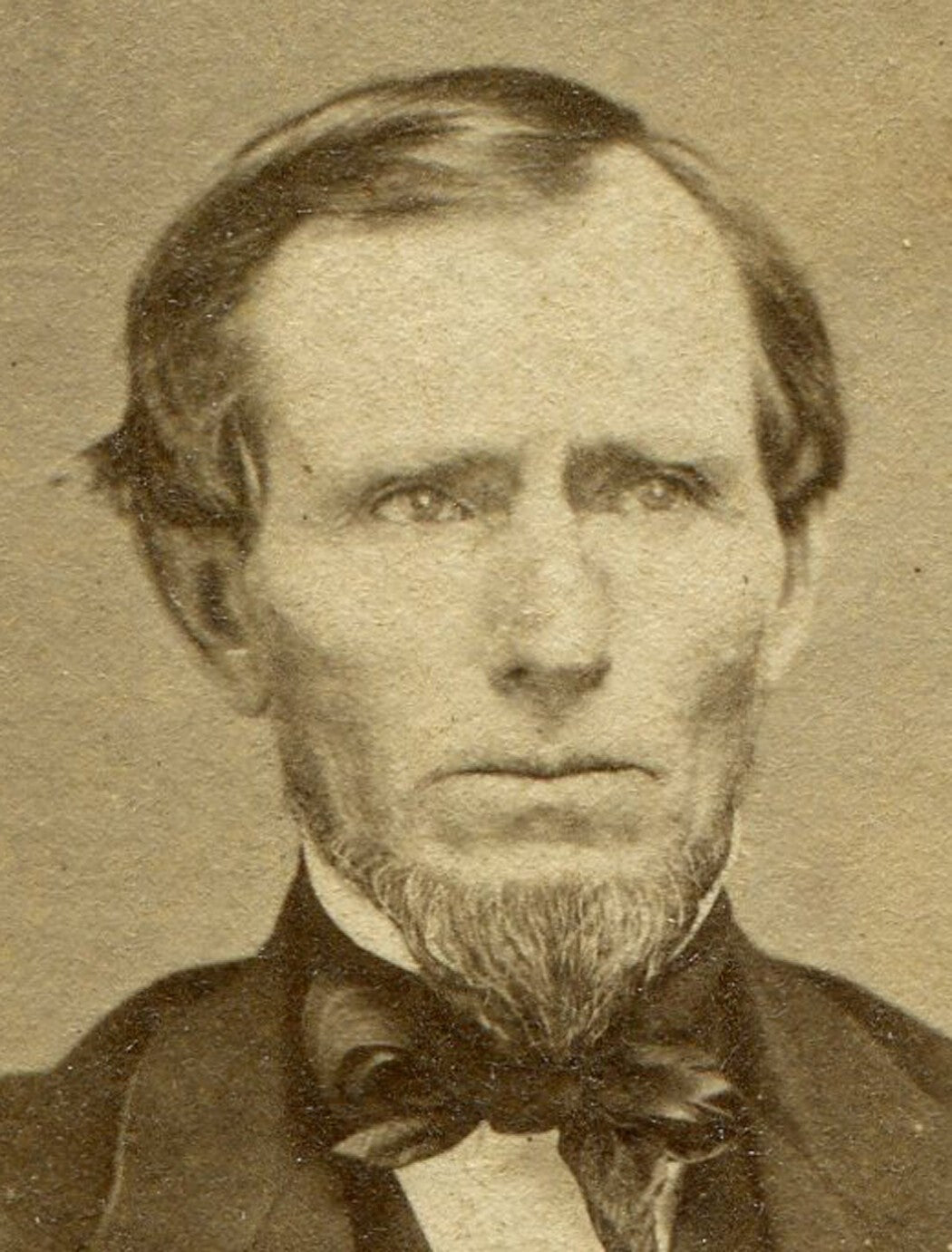 MAN HOLDING BACK TEARS. CDV.