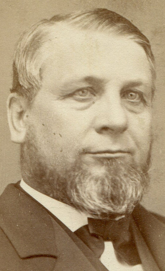 MAN WITH BAGS UNDER EYES. CDV. SPRINGFIELD, MASS.
