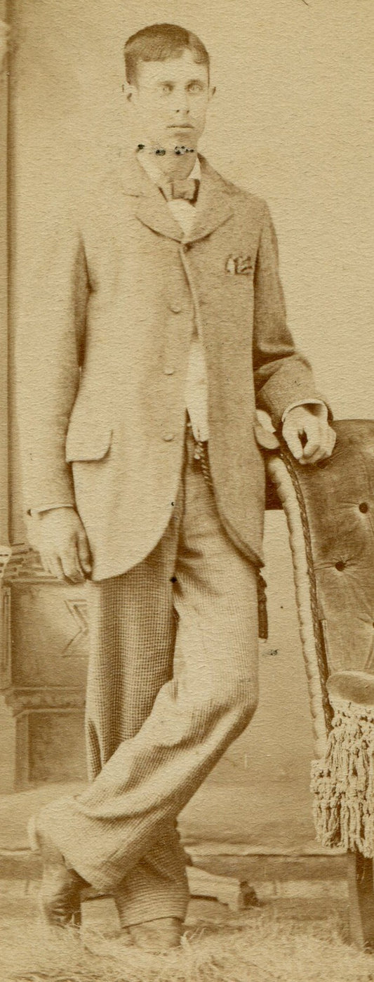 TALL THIN MAN WITH BUG EYES. CDV.