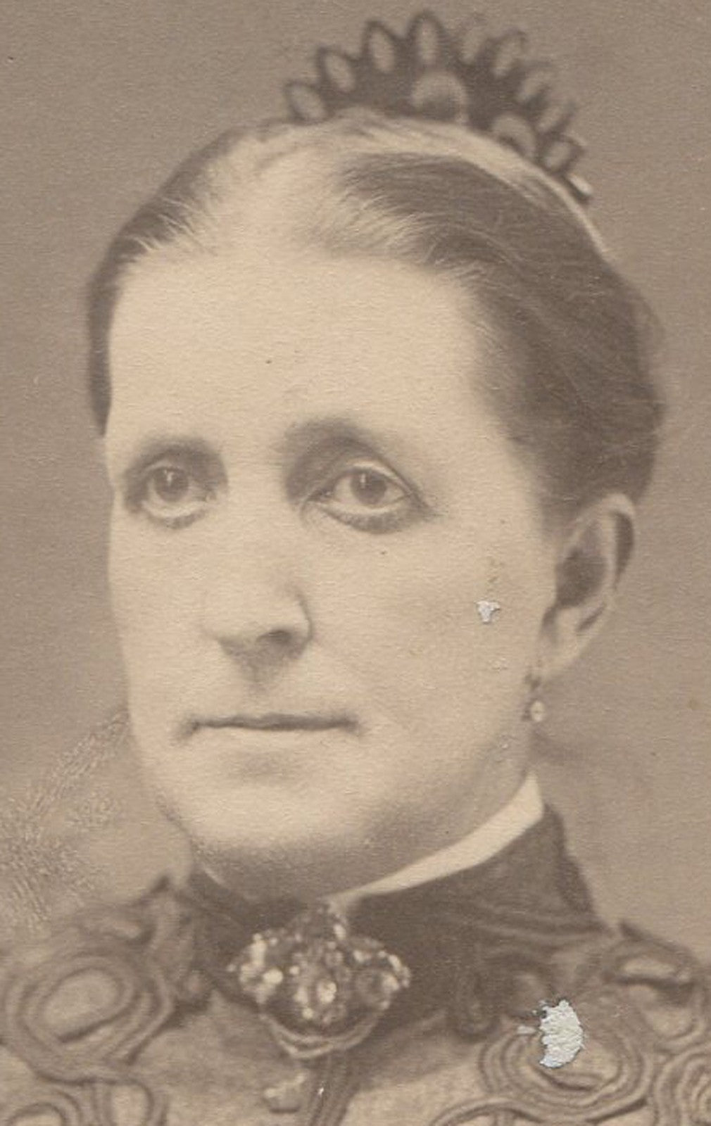 Vintage Cabinet Card Portrait: Odd-Eyed Woman in Embellished Dress - Original