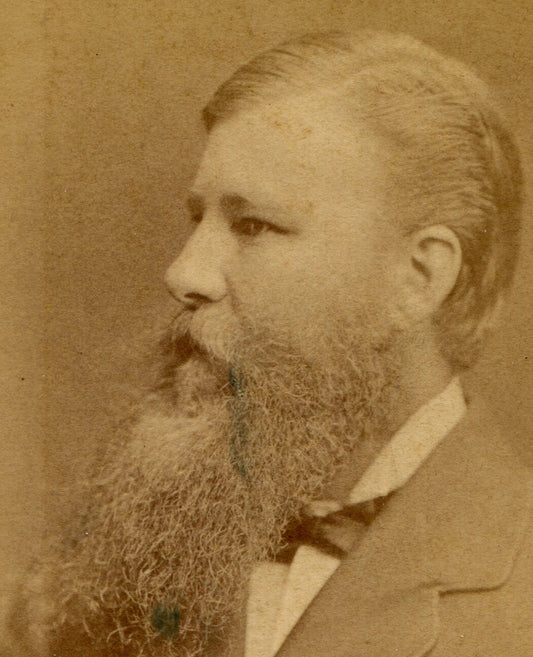 FLESHY FACED MAN WITH IMPRESSIVE BEARD. CDV. STOCKHOLM, SWEDEN.