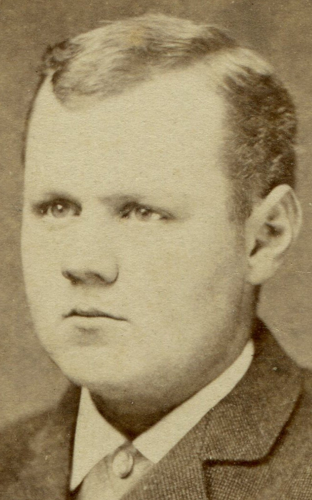 MAN, SAD/ANGRY EXPRESSION. CDV.