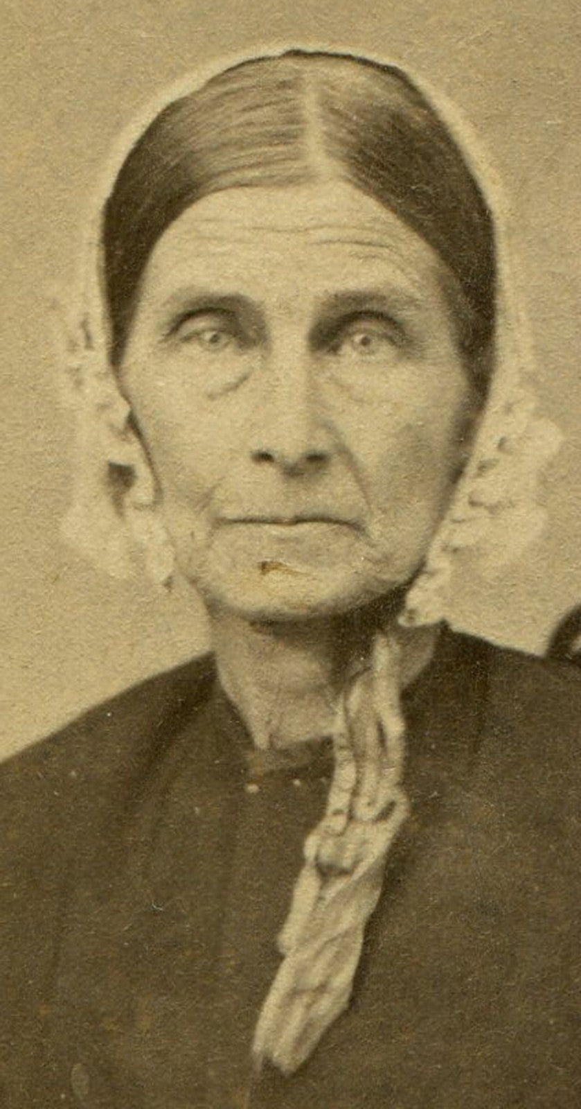 CIVIL WAR ERA TAX STAMP. THIN OLD WOMAN IN BONNET. CDV. CANTON, ILL.