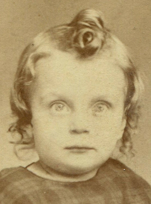 BRIGHT EYED TODDLER WITH KEWPIE DOLL CURL. CDV, BOSCOBEL, WISCONSIN.