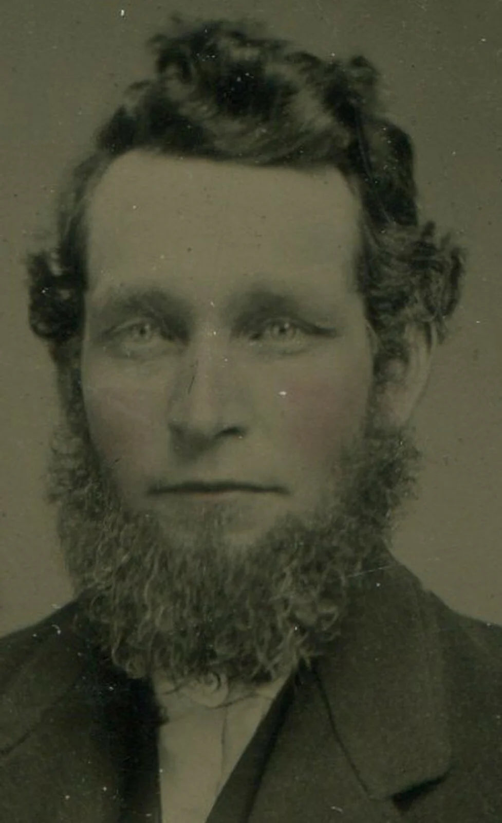 SAD EYED MAN, FUZZY BEARD. TINTED TINTYPE, PERIOD PAPER MAT. PHILADELPHIA, PA.