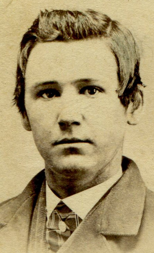 PUDDY FACED YOUNG MAN, THICK HAIR. CDV. TROY, N.Y.