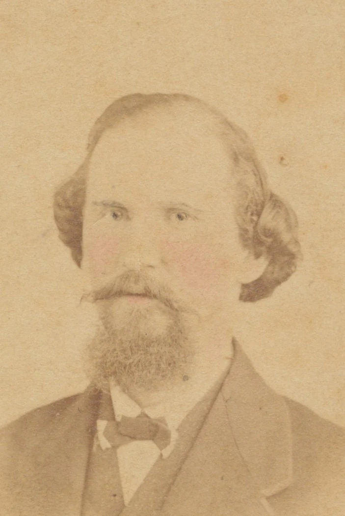 Man w/ Scraggly Hair, Beard in Three Piece Suit. Hand Tinted CDV. Petersburg, VA